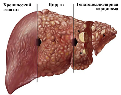 ciros5.jpg